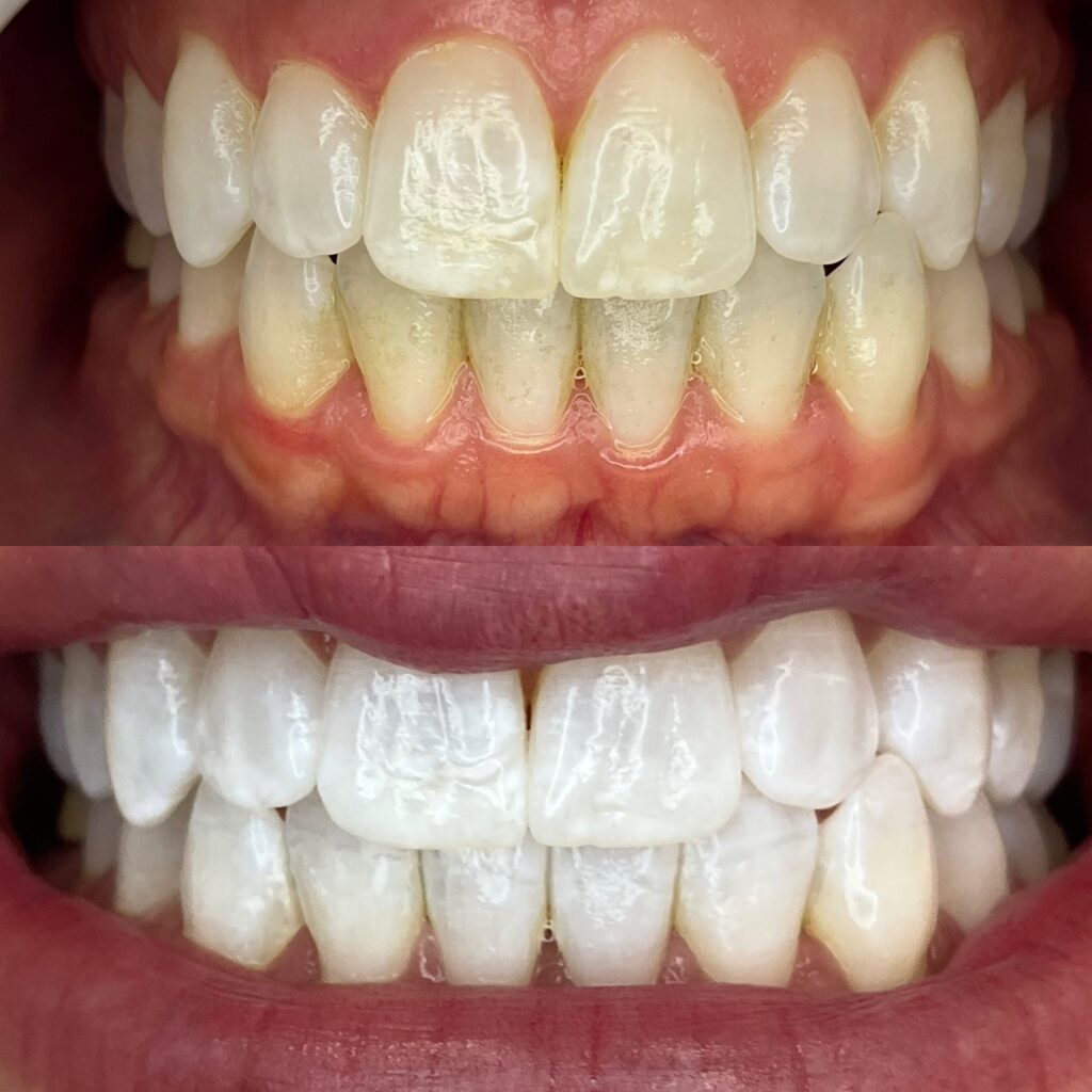 Dr Katie of Inclusive Natural Medicine smiles with her bright white teeth.